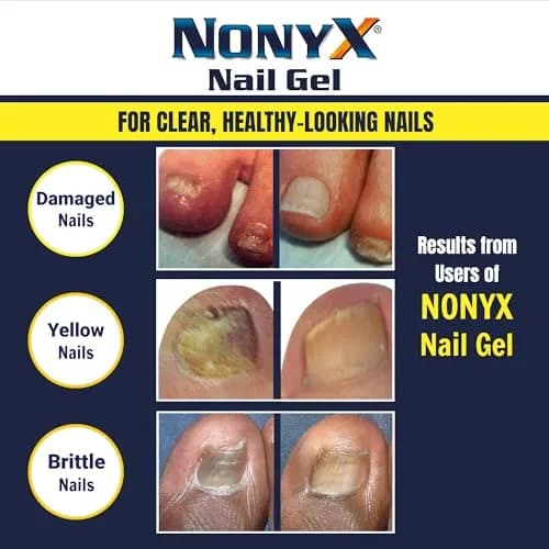 NONYX Fungal Nail Clarifying Gel 118ml (4 Fl Oz) | Clinically Proven to Improve Nail Appearance thumbnail 5