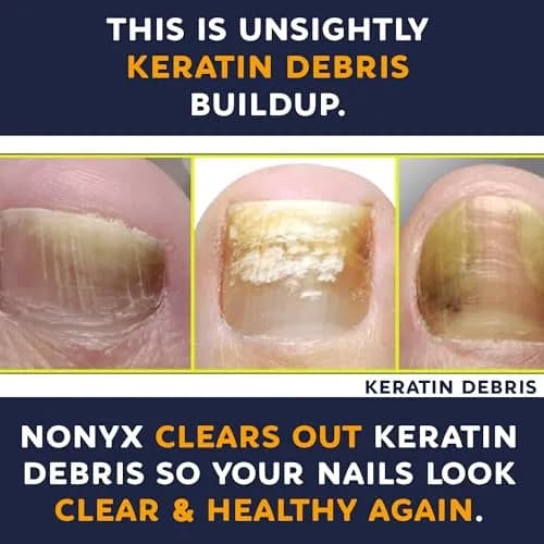 NONYX Fungal Nail Clarifying Gel 118ml (4 Fl Oz) | Clinically Proven to Improve Nail Appearance thumbnail 7