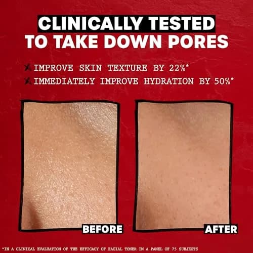 THAYERS Alcohol-Free Hydrating Original Witch Hazel Facial Toner with Aloe Vera 355ml (12 Fl Oz) | Dermatologist Tested thumbnail 7
