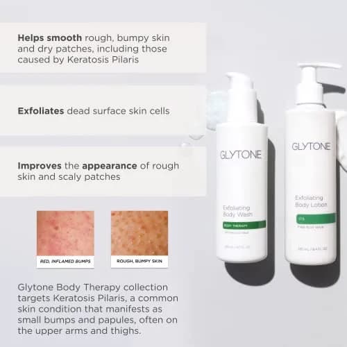 GLYTONE Glytone Exfoliating Body Lotion for Dry Skin | 17.5% PFAV Glycolic Acid, Reduce Keratosis Pilaris, Fragrance-Free, 8.4 Fl Oz thumbnail 5
