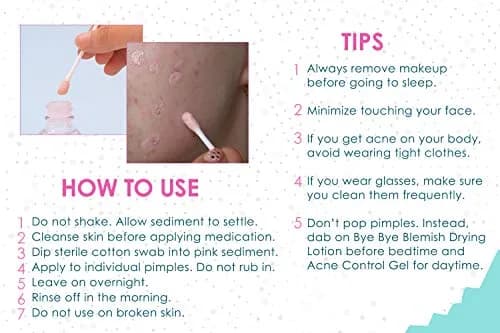 Bye Bye Blemish Acne Drying Lotion 1oz | Reduce Pimples Overnight for Sensitive Skin thumbnail 4