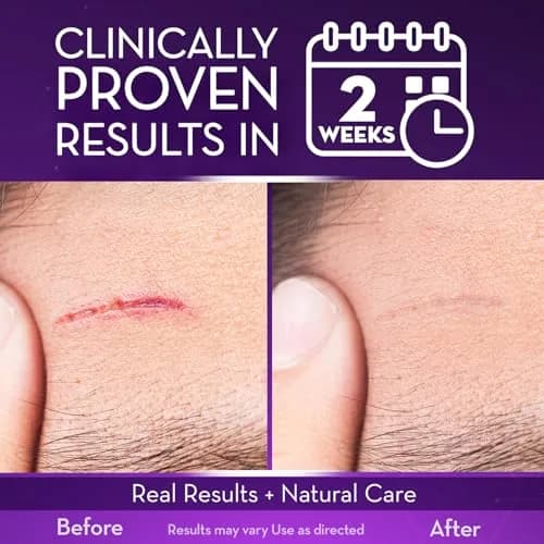 Cicatricure Advanced Scar Gel 28g (1 oz) | Clinically Proven Scar Treatment thumbnail 3