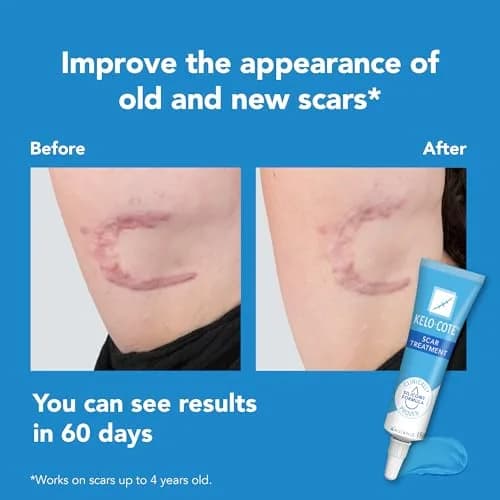 KELO-COTE Silicone Scar Gel 6g | Waterproof, Softens & Flatten Hypertrophic & Keloid Scars thumbnail 5