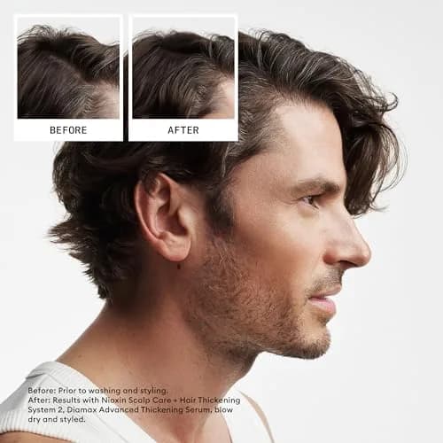 Nioxin System 2 Shampoo for Natural Hair with Progressed Thinning, 298 ml (10.1 Fl Oz) | Thickens Hair & Supports Scalp Health thumbnail 2