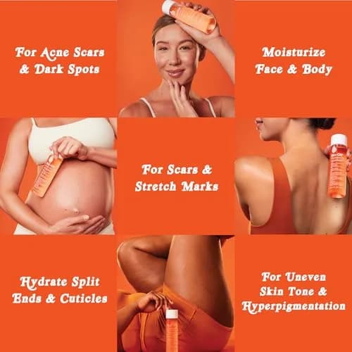 Bio-Oil Skincare Body Oil Serum 200ml (6.7 Fl Oz) | Helps Improve Scars & Stretch Marks thumbnail 5