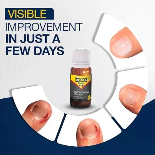 URIEL Ingrown Toenail Treatment 11 ml | Supports Nail Health & Comfort for Home Use thumbnail 2