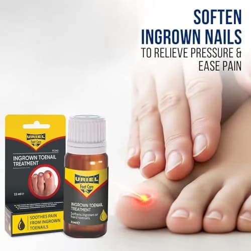 URIEL Ingrown Toenail Treatment 11 ml | Supports Nail Health & Comfort for Home Use thumbnail 3