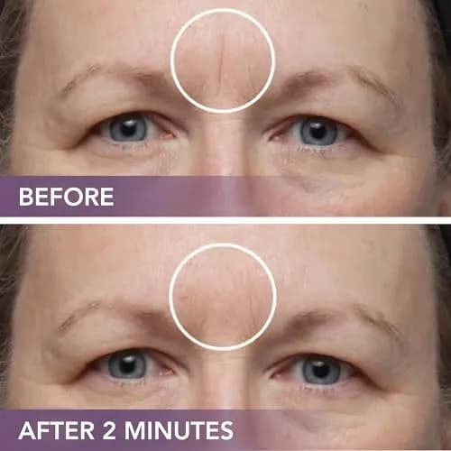 Dermaflage Scar Filler Kit Bronze Medium Waterproof Concealer for Acne Scars Wrinkles Ice Pick Scars Makeup | 1 mo supply thumbnail 6