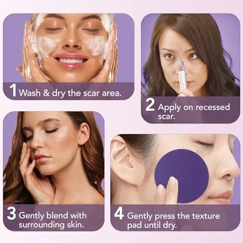 Dermaflage Scar Filler Kit - Deep Skin Tone Waterproof Concealer for Acne & Wrinkles, 1 Count thumbnail 6