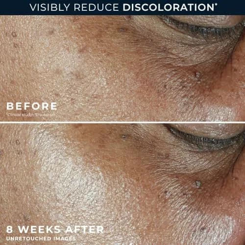 RoC Multi Correxion 5 in 1 Anti-Aging Daily Facial Moisturizer SPF 30 50ml (1.7 oz) | With Shea Butter & Hexyl-R Complex thumbnail 6