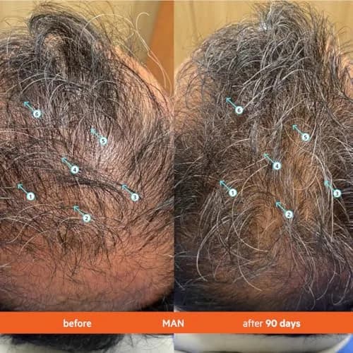 DS Labs Revita Hair Density Shampoo for Thinning Hair | 410ml (7 Fl Oz x 2) | Supports Scalp Wellness & Fuller Looking Hair thumbnail 3