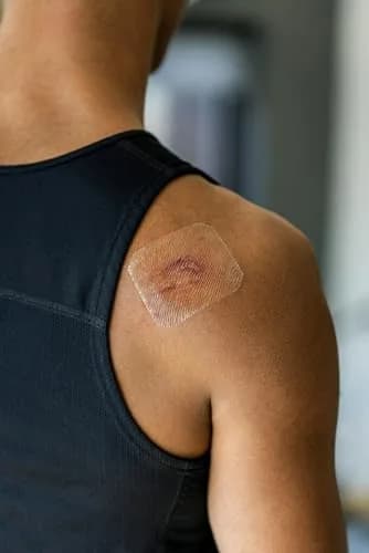 Nexcare Tegaderm Transparent Dressing, Clear Film | Waterproof, Breathable, 7-Day Wear, 10 Dressings thumbnail 9