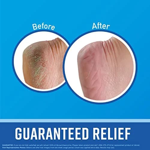 O'Keeffe's Working Hands Hand Cream & Healthy Feet Foot Cream Combo Pack 100.6g (3.4 oz + 3.2 oz) | Intensive Dry Skin Repair thumbnail 6
