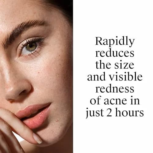 Neutrogena Rapid Clear Stubborn Acne Spot Treatment Gel 1 oz | Maximum Strength 10% Benzoyl Peroxide for Acne Prone Skin thumbnail 6