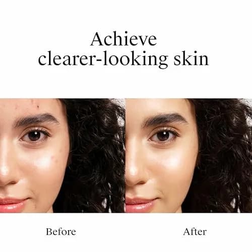 Neutrogena Rapid Clear Stubborn Acne Spot Treatment Gel 1 oz | Maximum Strength 10% Benzoyl Peroxide for Acne Prone Skin thumbnail 3