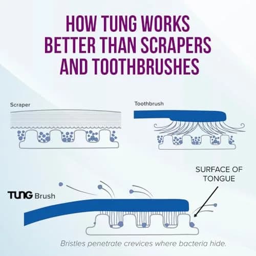 Peak Essentials The Original TUNG Brush Tongue Cleaner 4-Pack | Dentist-Designed for Bad Breath Defense thumbnail 5