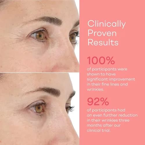 LightStim for Wrinkles LED Red Light Therapy with 72 LEDs | FDA Cleared Anti-Aging Device thumbnail 4