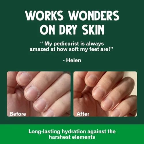 Bag Balm Vermont's Original Skin Moisturizer 4oz | Full-Body Hydrating Skin Care for Dry Hands & Lips thumbnail 4