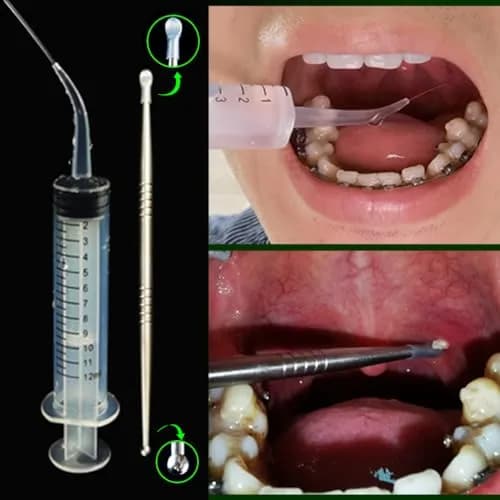 airgoesin Tonsil Stone Remover LED Kit with Irrigator & Steel Pick for Fresh Breath (17 Piece Set) thumbnail 4