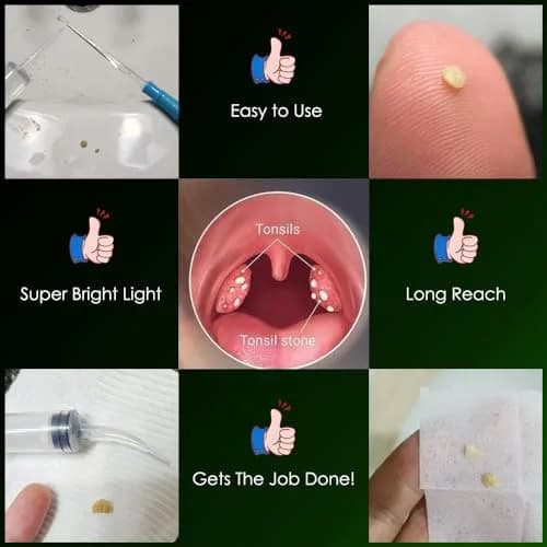 airgoesin Tonsil Stone Remover LED Kit with Irrigator & Steel Pick for Fresh Breath (17 Piece Set) thumbnail 6