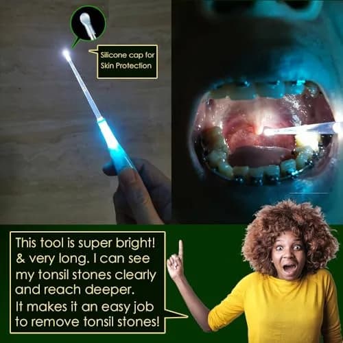 airgoesin Tonsil Stone Remover LED Kit with Irrigator & Steel Pick for Fresh Breath (17 Piece Set) thumbnail 3