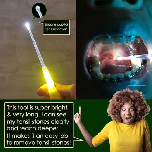 Airgoesin Tonsil Stone Remover LED Tool Kit 2 Sets | Painless Removal for Fresher Breath thumbnail 3