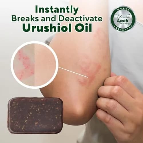 Marie Originals Poison Ivy Soap Bar | All Natural Poison Ivy Treatment | Anti-Itch Skin Cleanser Bar Wash for Poison Ivy, Poison Oak & Sumac | Soothes & Relieves Rashes | 2.9 Ounces thumbnail 5