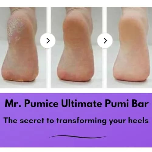 Mr. Pumice Ultimate PUMI Bar 2-in-1 Dual Grit (Medium + Coarse) Callus Remover for Feet & Heels | 4 Pack thumbnail 3