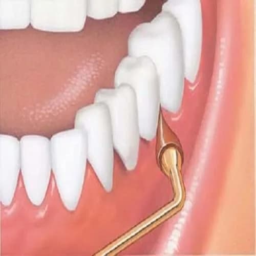 GUM Stimulator Permanent Handle with Rubber Tip | Eco-Friendly Dental Massager for Healthy Gums thumbnail 2