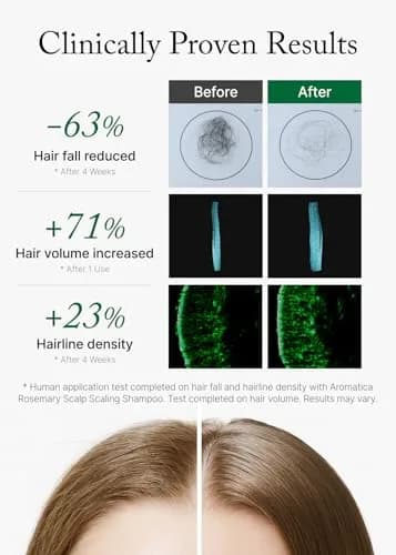AROMATICA Rosemary Scalp Scaling Shampoo for Hair Growth 400ml (13.53 Fl Oz) | Vegan Formula for Hair Fall & Scalp Health thumbnail 4