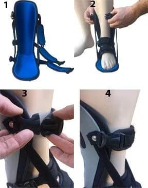 Alpha Medical Plantar Fasciitis Night Splint Medium | Adjustable Dorsiflexion for Achilles Tendonitis & Heel Pain thumbnail 7