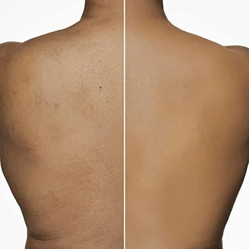 Dermablend Leg & Body Makeup Foundation SPF 25, 20N Light Natural, 100ml (3.4 fl oz) | Full Coverage for Scars & Imperfections thumbnail 7