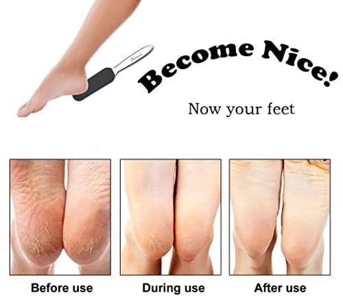 Homeve Pedicure Foot File Reusable Stainless Steel Cracked Skin Callus Remover Feet Rasp | Ergonomic & Durable thumbnail 7