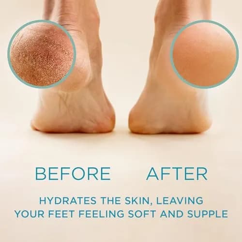 Lee Beauty Professional Gel Callus Remover 8oz (237ml) | Fast-Acting Formula for Smoother Feet thumbnail 2