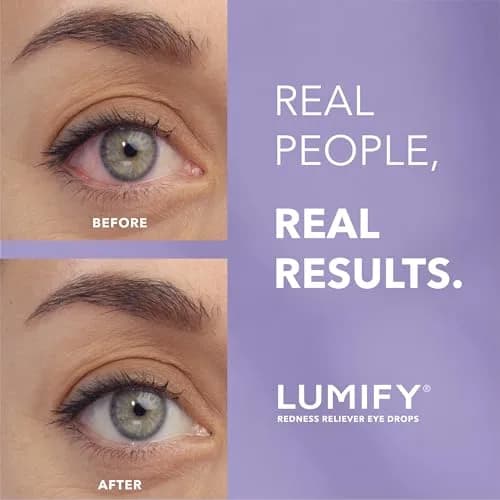 LUMIFY Redness Relief Eye Drops 7.5ml (0.25 Fl Oz) | for Whiter, Brighter Eyes thumbnail 2