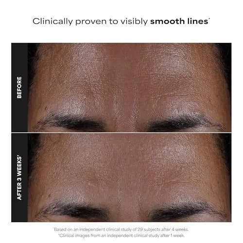 Paula's Choice SKIN PERFECTING 2% BHA Liquid Exfoliant 150ml (5 Fl Oz) | Gentle Non-Abrasive Leave-On Exfoliant for Pores & Blackheads thumbnail 3