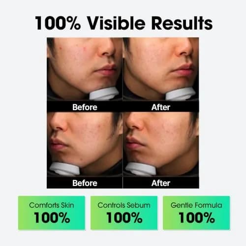 SOME BY MI AHA BHA PHA Miracle Cream 60ml (2.02 Fl Oz) | Mild Refining & Centella Face Moisturizer thumbnail 8