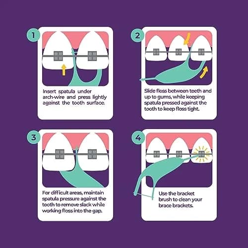 Platypus Orthodontic Flossers for Braces, 60 Count (Pack of 2) | Orthodontist Recommended for Daily Use thumbnail 3