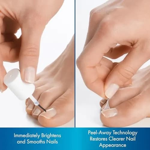 ProClearz Brite Now Nail Treatment 0.5 Fl Oz | Brightening & Smoothing Nail Repair thumbnail 3
