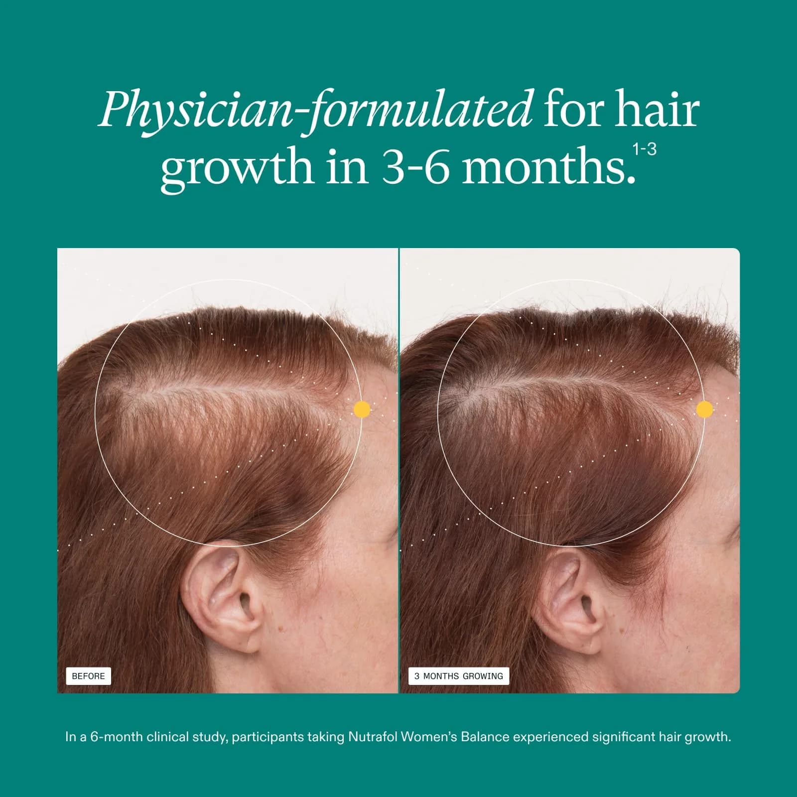 Nutrafol Women's Balance Hair Growth Supplements for Ages 45+, Clinically Tested for Thicker Hair & Scalp Coverage, 1 Month Supply thumbnail 4
