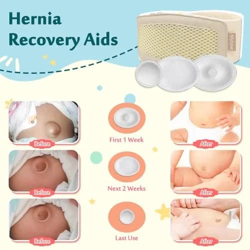 Mybow Umbilical Hernia Belt Baby | Gentle Support for Newborns thumbnail 3