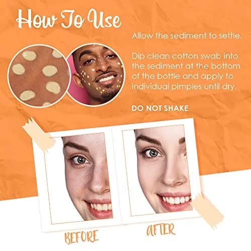 Bye Bye Blemish Vitamin C Lotion 30ml | Brightening & Drying Blemishes Support thumbnail 4