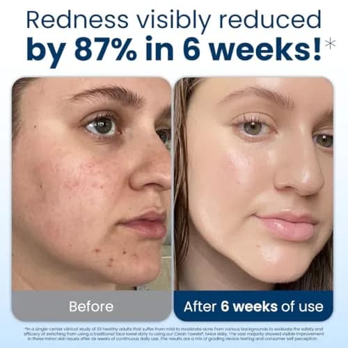 Clean Skin Club Clean Towels XL® Disposable Face Towels 300 Ct (6 Packs of 50 Ct) | USDA Biobased & Eczema Association Accepted thumbnail 3