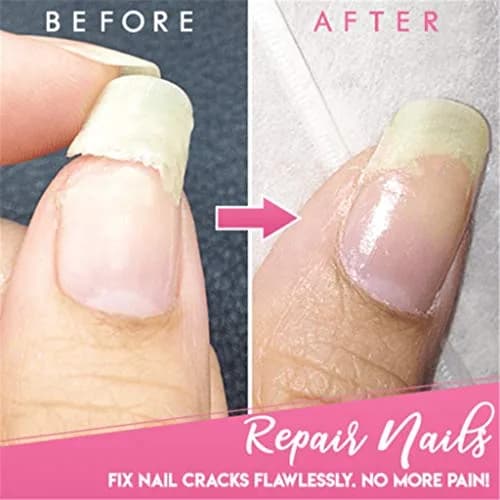 succeedtop Gel Nail Treatment 5ml | Instant Crack Repair & Strengthener thumbnail 4