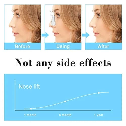 FERNIDA Nose Shaper Lifter Uplifting Clip 1 Count | Pain-Free Silicone Nose Bridge Straightener for Women, Men thumbnail 2
