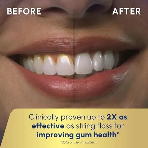 Waterpik Cordless Advanced Portable Water Flosser Gray 203ml (7 Fl Oz) | ADA Accepted Oral Irrigator thumbnail 5