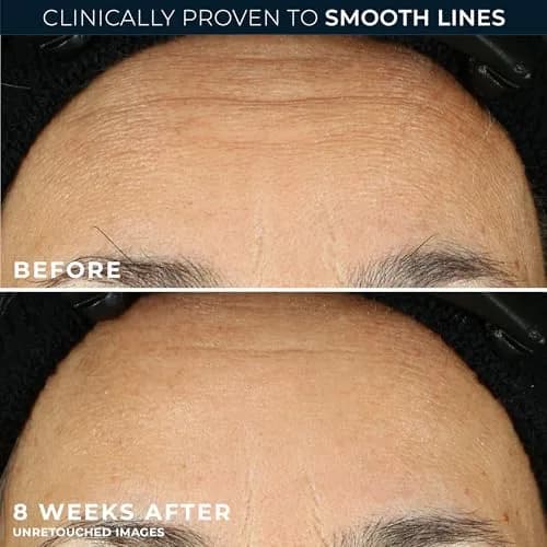 RoC Retinol Correxion Line Smoothing Night Serum Capsules 10 Count | Fragrance-Free Anti-Aging Treatment for Wrinkles thumbnail 4