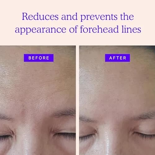 BLUMBODY Forehead Wrinkle Patches – Anti-Wrinkle Facial Patches to Smooth Fine Lines on Forehead & Between Eyes – Non-Silicone Face Tape – Comfortable Overnight Use (50 Count) thumbnail 2