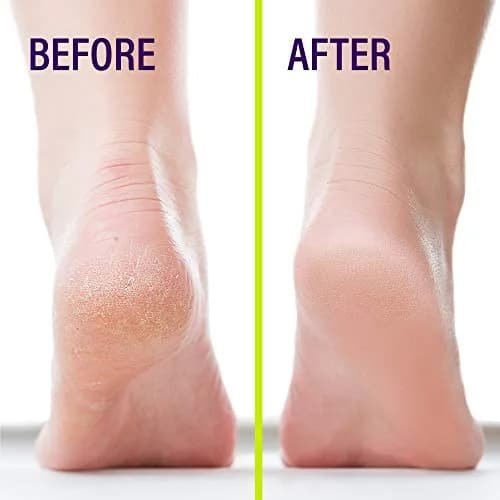 Heel-Seal Liquid Skin Protectant for Cracked Heels 14g (0.5 Oz) | Seals & Repairs Cracked Feet thumbnail 6