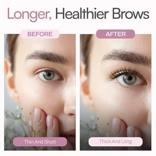 Foltene Eyelash & Eyebrow Treatment Serum 10ml (0.34 Fl Oz) | Stimulates Growth for Fuller, Longer Lashes & Brows thumbnail 7